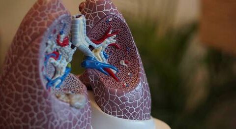 🇧🇪-Première mondiale: les hôpitaux anversois placent des stents dans les artères pulmonaires
